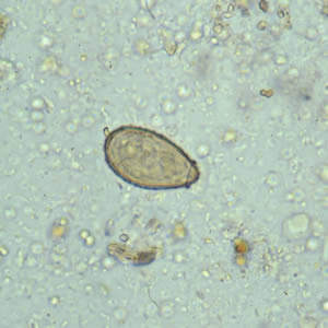 C. sinensis egg: the small knob at the abopercular end is visible in this image. Adapted from CDC