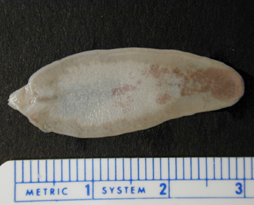 Unstained adult of F. hepatica fixed in formalin. Adapted from CDC