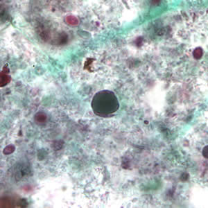 Blastocystis hominis cyst-like forms stained with trichrome. Adapted from CDC