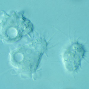 Trophozoites of Acanthamoeba sp. from culture. Notice the slender, spine-like acanthapodia. Adapted from CDC