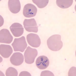 Babesia microti in a thin blood smear stained with Giemsa. Babesia sp. cannot be identified to the species level by morphology alone; additional testing, such as PCR, is always recommended. Note the tetrad form in this image. Adapted from CDC