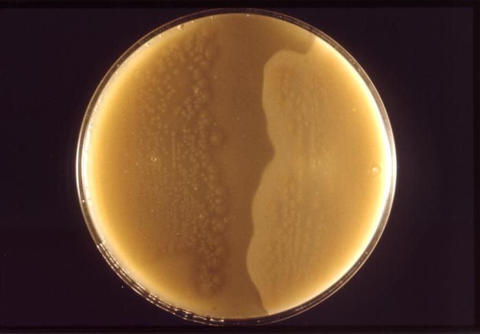 Clostridium perfringens colonies cultured on a half-antitoxin plate. From Public Health Image Library (PHIL). [1]