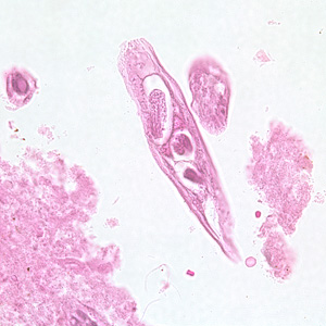 Longitudinal section of an adult of C. philippinensis from an intestinal biopsy specimen stained with hematoxylin and eosin (H&E). Adapted from CDC