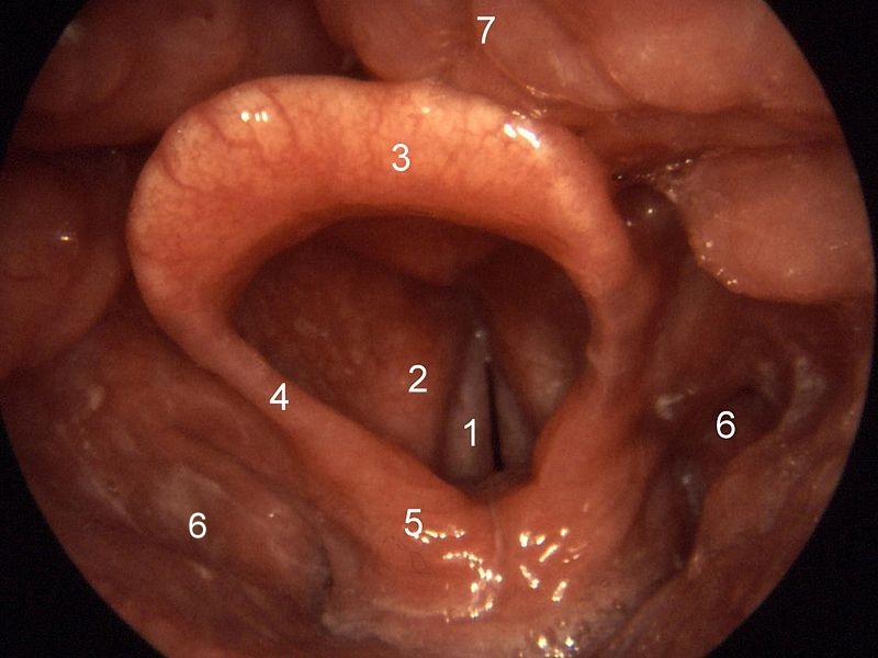 File:Epiglottis.jpg
