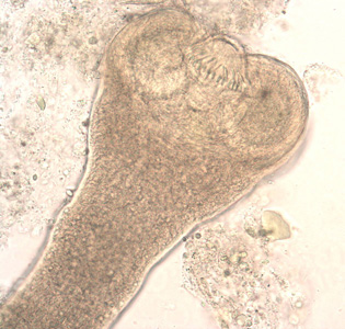 Higher magnification of the scolex in Figure 2. In this image, two of the suckers and the rostellar hooks are clearly visible. Adapted from CDC