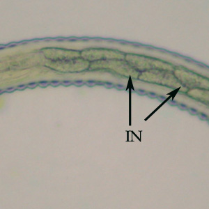 Mid-section of the specimen in Figures 1 and 2. Notice the alternating triangular-shaped intestinal cells (IN). Adapted from CDC