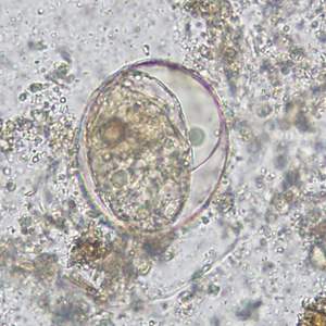 Egg of S. japonicum in an unstained wet mount of stool. The spine is not visible in either of these specimens. Adapted from CDC