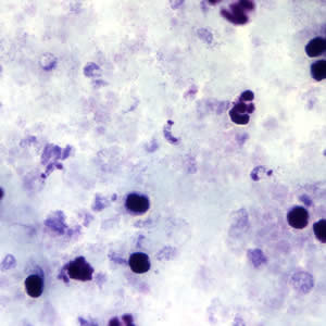 Trypanosoma cruzi in thick blood smears stained with Giemsa. Adapted from CDC
