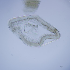 Cross-section of Anisakis sp., viewed under DIC microscopy. Adapted from CDC