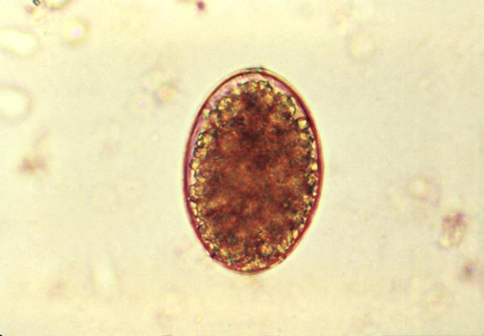 Micrograph reveals an egg of tapeworm cestode parasite Diphyllobothrium latum. Source: https://phil.cdc.gov/phil/home.asp
