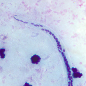 Close-up of the posterior end of the worm in Figure 3. Adapted from CDC