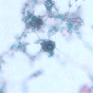 Trophozoite of E. gingivalis from culture, stained with trichrome. Adapted from CDC