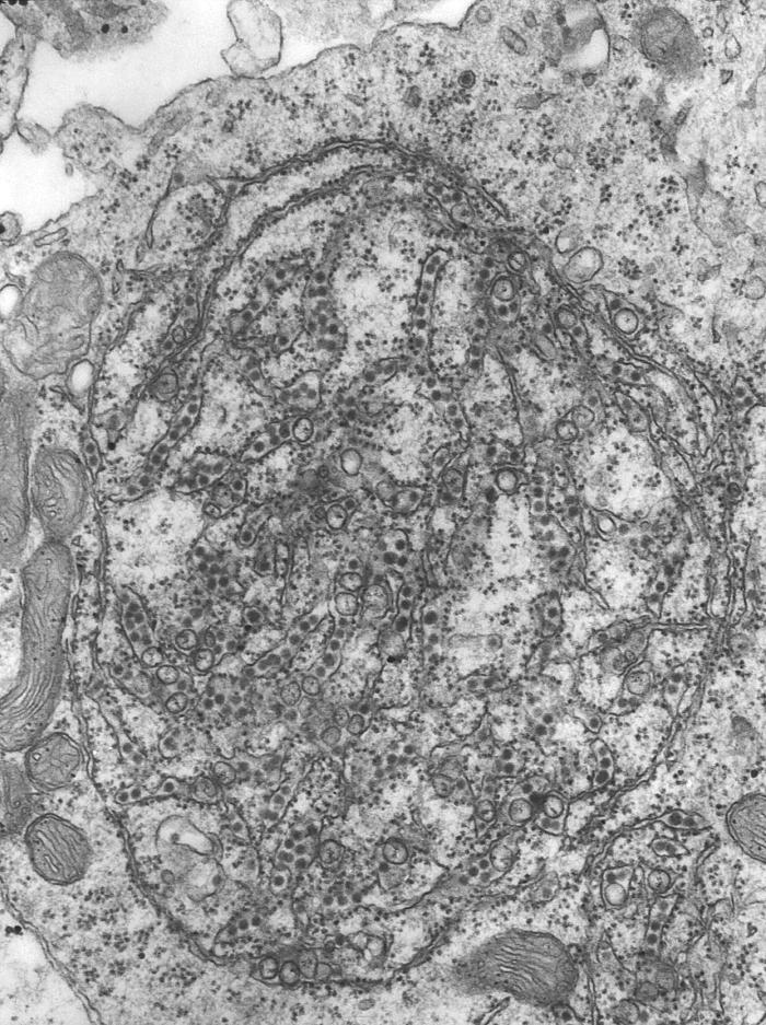 Transmission electron micrograph (TEM) reveals the presence of numerous St. Louis encephalitis (SLE) virions contained inside a neuron. From Public Health Image Library (PHIL). [3]