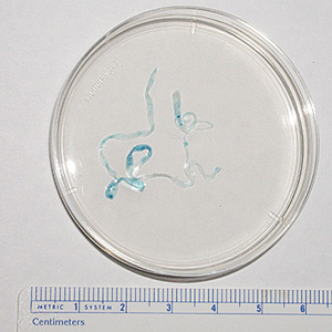 Sparganum removed from the chest wall of a patient. The worm measured about 70 mm long. Images from a specimen courtesy of the Oklahoma State Department of Health. Adapted from CDC