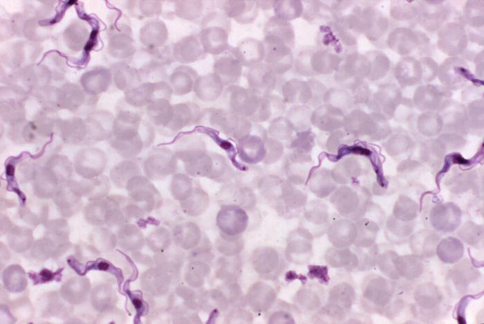 File:African trypanosomiasis03.jpeg