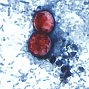 A pair of oocysts of C. cayetanensis stained with safranin (SAF). Adapted from CDC