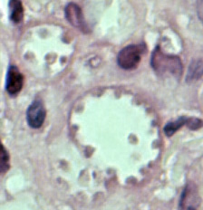 Leishmania mexicana in a biopsy specimen from a skin lesion stained with H&E. The amastigotes are lining the walls of two vacuoles, a typical arrangement. The species identification was derived from culture followed by isoenzyme analysis. Adapted from CDC