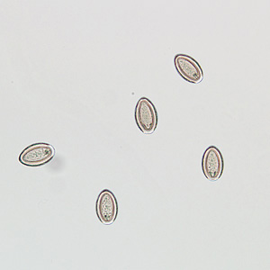 Eggs of M. moniliformis liberated from an adult worm that was recovered from the stool of a patient. Adapted from CDC