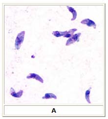 Toxoplasma gondii tachyzoites, stained with Giemsa