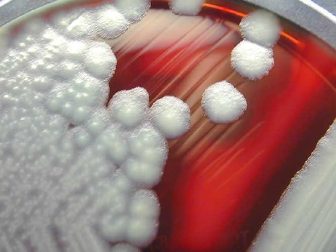 Bacillus cereus showing hemolysis on sheep blood agar. From Public Health Image Library (PHIL). [22]