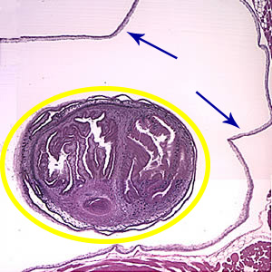 An entire cysticercus seen within the bladder walls (blue arrows). A single scolex is visible inside yellow circle) within the cyst. Adapted from CDC