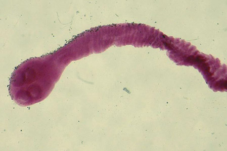 Scolex of Bertiella studeri. Image courtesy of Richard Bradbury. Adapted from CDC