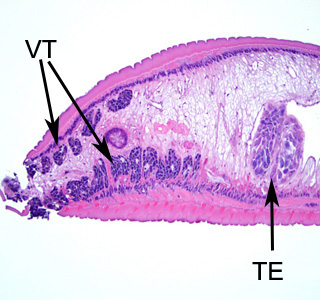 Higher magnification of the posterior end of the specimen in Figure 1. Notice the vitelline glands (VT) and lobed testes (TE). Adapted from CDC