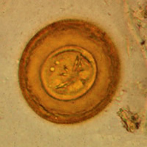 Egg of H. diminuta in an unstained wet mount of concentrated stool. Image taken at 400x magnification. Adapted from CDC