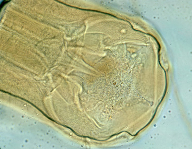 Adult worm of Necator americanus. Anterior end showing mouth parts with cutting plates. Adapted from CDC