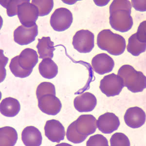 Trypanosoma brucei ssp. in a thin blood smear stained with Wright-Giemsa. Adapted from CDC