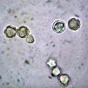 Cysts of Acanthamoeba spp. in culture. Adapted from CDC