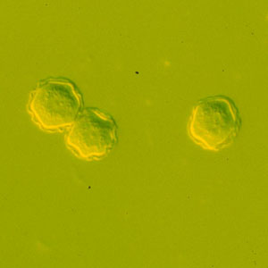 Cysts of Acanthamoeba spp. in culture. Adapted from CDC