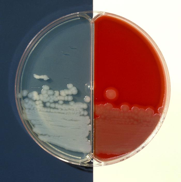 Blood agar and bicarbonate agar plate cultures of Bacillus cereus. From Public Health Image Library (PHIL). [22]