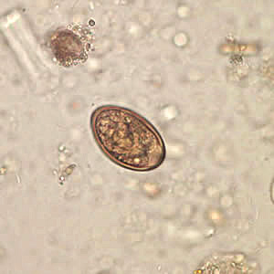 Egg of Dicrocoelium dendriticum in an unstained wet mount of stool. Image courtesy of Dr. Juan Cuadros González. Adapted from CDC