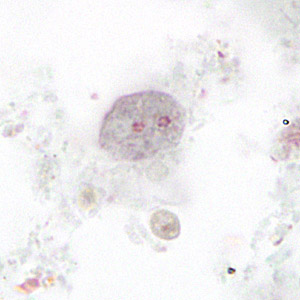 Binucleate form of a trophozoite of D. fragilis, stained with trichrome. Adapted from CDC