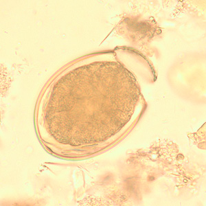 Egg of D. latum in an unstained wet-mount of stool. Adapted from CDC
