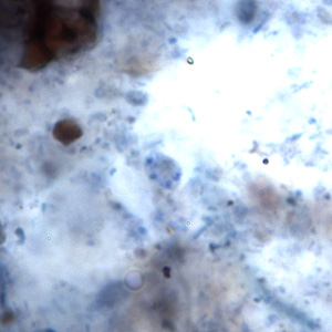 Cyst of E. hominis, possessing four nuclei, in a stool specimen stained with iron-hematoxylin. Adapted from CDC
