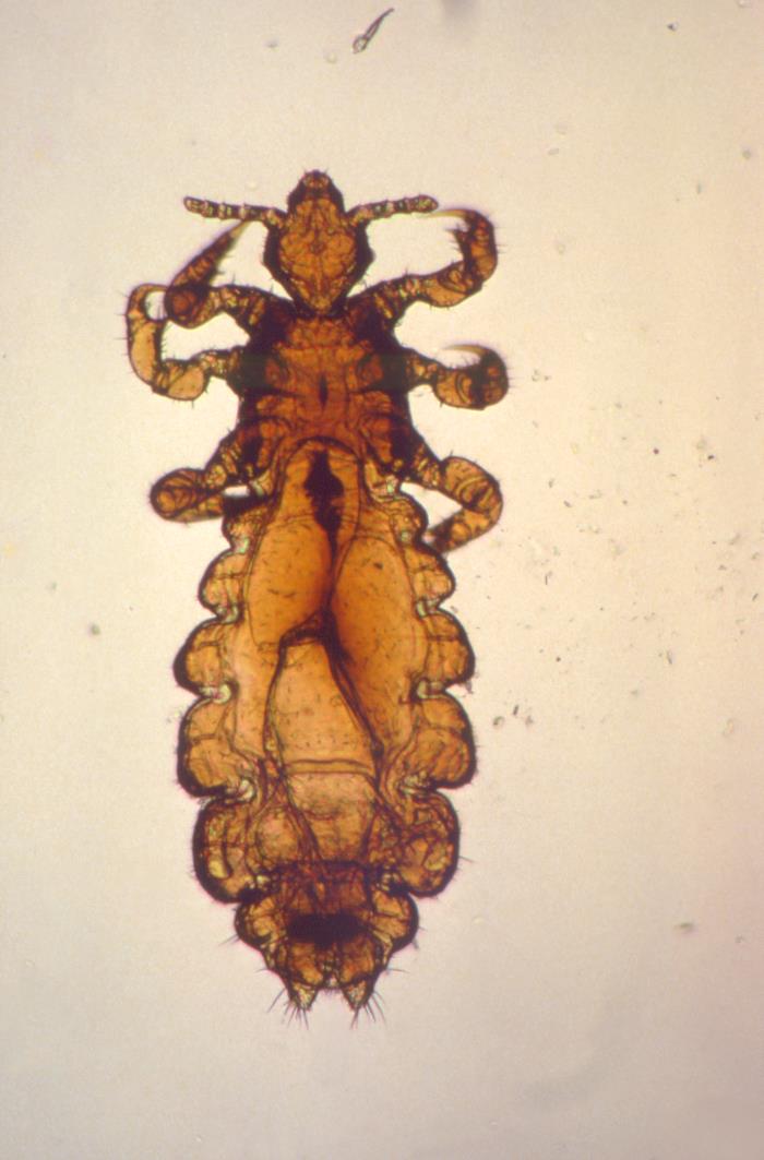 This photomicrograph depicts a dorsal view of an adult female human head louse, Pediculus humanus capitis. Lice are parasitic insects that can be found on people's heads, and bodies, including the pubic area. Human lice survive by feeding on human blood. Lice found on each area of the body are different from each other. The three types of lice that live on humans are: Pediculus humanus capitis (head louse), Pediculus humanus corporis (body louse, clothes louse) and Pthirus pubis ("crab" louse, pubic louse). Only the body louse is known to spread disease. Lice infestations (pediculosis and pthiriasis) are spread most commonly by close person-to-person contact. Dogs, cats, and other pets do not play a role in the transmission of human lice. Lice move by crawling; they cannot hop or fly. Both over-the-counter and prescription medications are available for treatment of lice infestations. Adapted from CDC