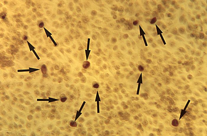This McCoy cell monolayer micrograph reveals a number of intracellular C. trachomatis inclusion bodies; Magnified 50X. The intracellular inclusion body represents the replication phase of the Chlamydia spp. organisms, whereupon, the reorganized reticulate body (RB) multiplies through binary fission into 100-500 new RBs, which mature into elementary bodies (EB). Adapted from CDC