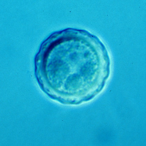 Cyst of B. mandrillaris. Adapted from CDC