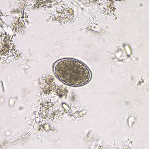 Eggs of D. latum in an unstained wet mount. Adapted from CDC