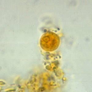 Cyst of an E. hartmanni in a wet mount, stained with iodine. Adapted from CDC