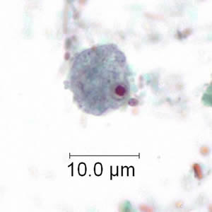 Trophozoite of E. nana stained with trichrome. Image courtesy of the Kansas Department of Health and Environment. Adapted from CDC