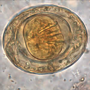 Egg of H. nana in an unstained formalin ethyl acetate (FEA) wet mount. In this image, four of the hooks in the oncosphere are clearly visible. Image courtesy of the Oregon State Public Health Laboratory. Adapted from CDC