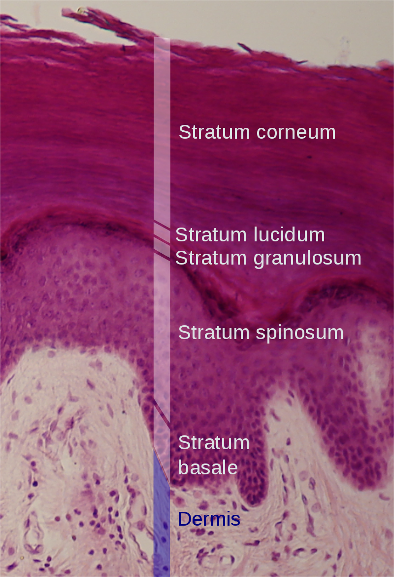 File:800px-Epidermal layers.svg.png