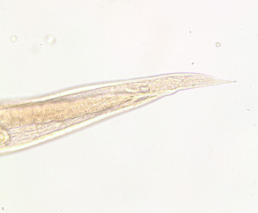 Posterior end of the same specimen as Figure 1. Note the pointed tail. Image taken at 200x magnification. Adapted from CDC