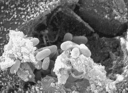 Scanning electron micrograph showing an eukaryotic cell bursting and releasing spores of Encephalitozoon hellem to the extracellular medium. Adapted from CDC