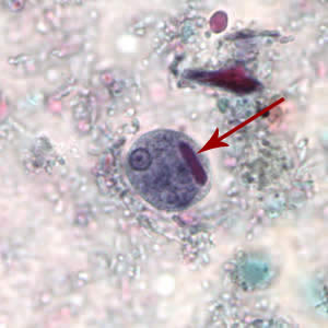 Cyst of E. histolytica/E. dispar stained with trichrome. Note the chromatoid body with blunt ends (red arrow).