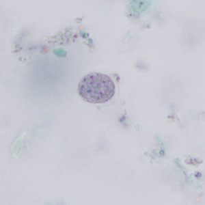 Cyst of E. nana stained with trichrome. Adapted from CDC
