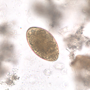 Egg of Echinostoma sp. in an unstained wet mount of stool. Image taken at 400x magnification. Adapted from CDC